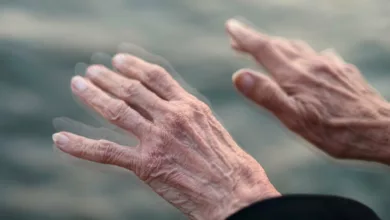 Parkinson