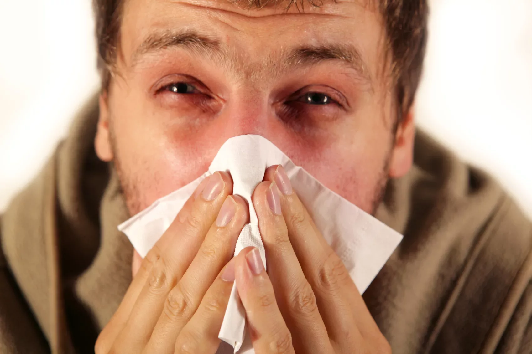 5 natürliche Antihistaminika - Kräuter, die Allergikern helfen können