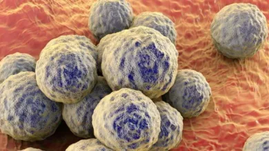 mrsa-1