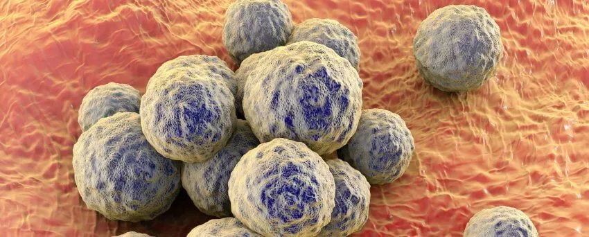 Neue Studie: Thymianöl zeigt Erfolg bei der Abtötung von MRSA