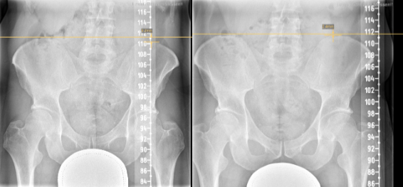 Achillessehnenbeschwerden – Ursachen und Behandlung: neue Aussichten