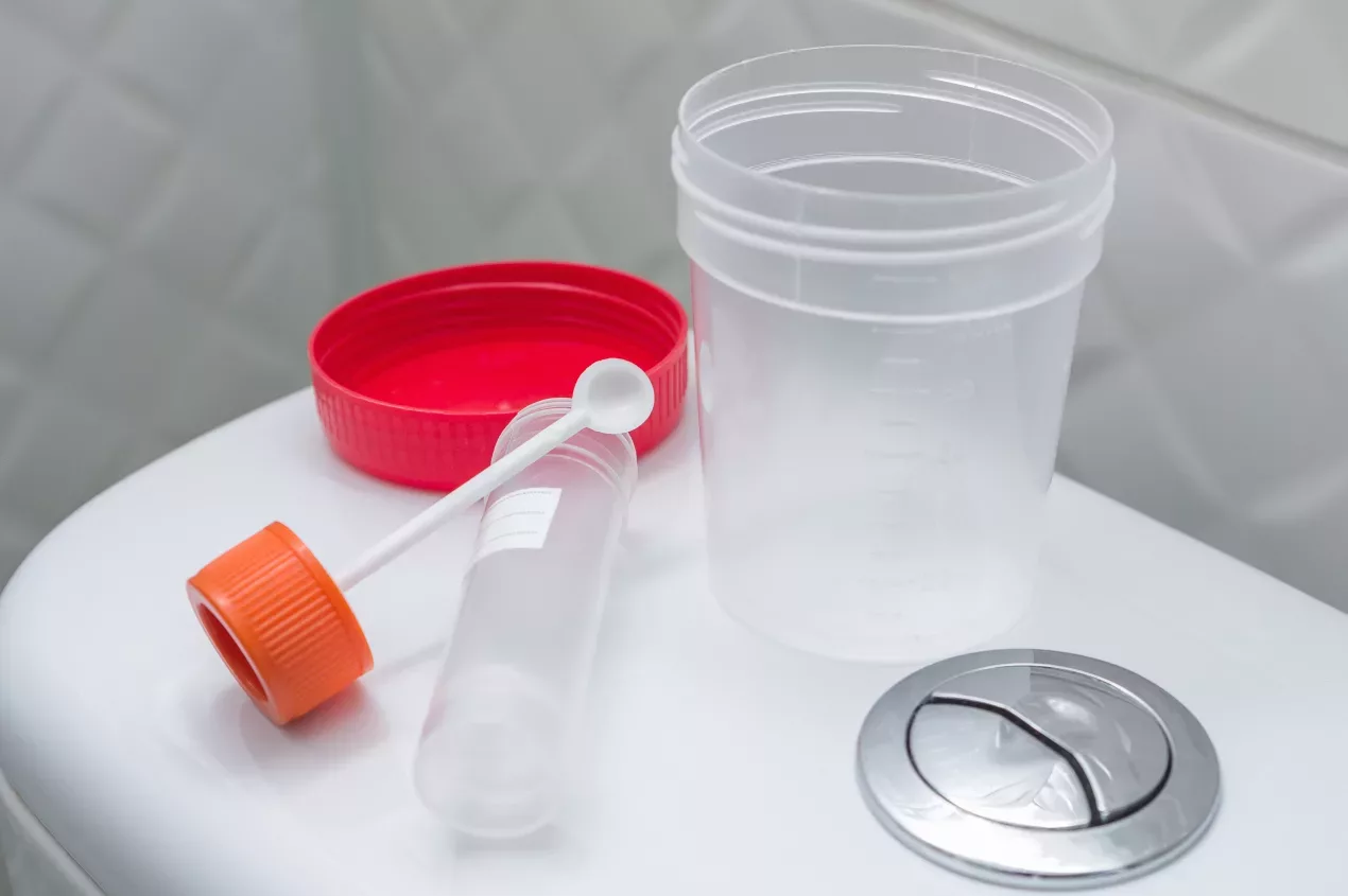 Welche Normen müssen Urinprobebehälter und Stuhlbehälter erfüllen?