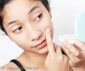 Hausmittel gegen Akne / Pickel