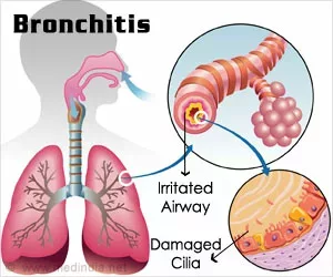 Hausmittel gegen Bronchitis