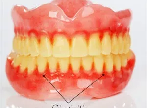 1659619295_Hausmittel-gegen-Gingivitis