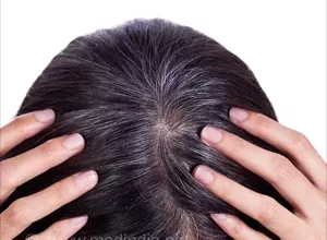 1659662616_Hausmittel-gegen-graues-Haar