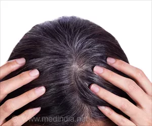Hausmittel gegen graues Haar