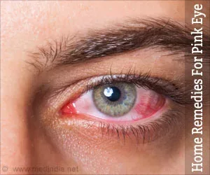 Hausmittel für Pink Eye