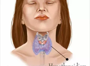 1659857541_Top-10-Hausmittel-zur-Behandlung-von-Hypothyreose