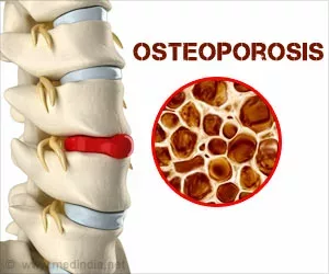 Hausmittel gegen Osteoporose
