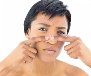 Top 12 Hausmittel zur Entfernung von Whiteheads