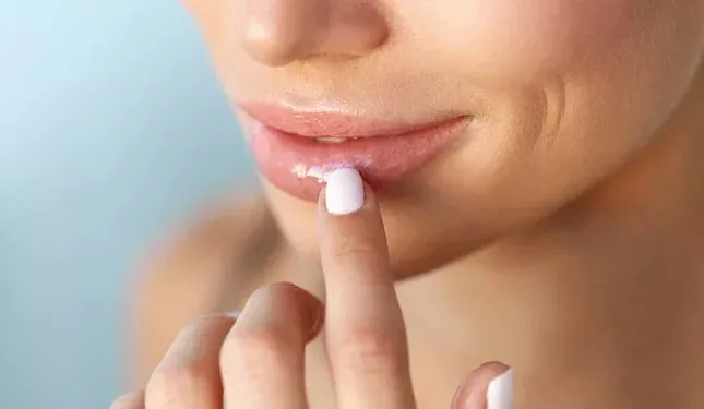 Warum werden meine Lippen immer dunkler?