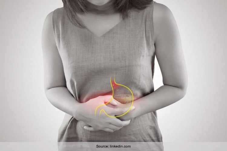 10 unglaubliche Hausmittel gegen Gastritis, die Sie kennen sollten