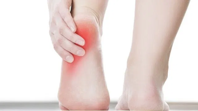 Chronische Fersenschmerzen? Vier Hausmittel gegen Plantarfasziitis