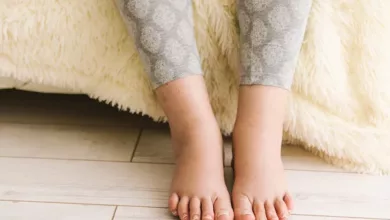 swollen-feet