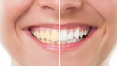 whiten-teeth