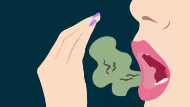 bad-breath