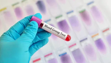blutgruppentest