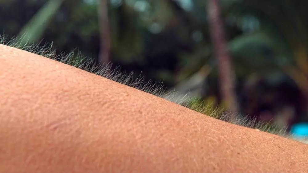Bekommen Sie Gänsehaut, wenn Sie Musik hören? Möglicherweise haben Sie ein besonderes Gehirn