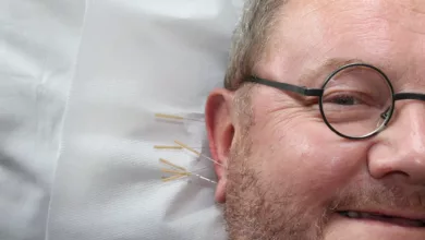 acupuncture-364613_1920