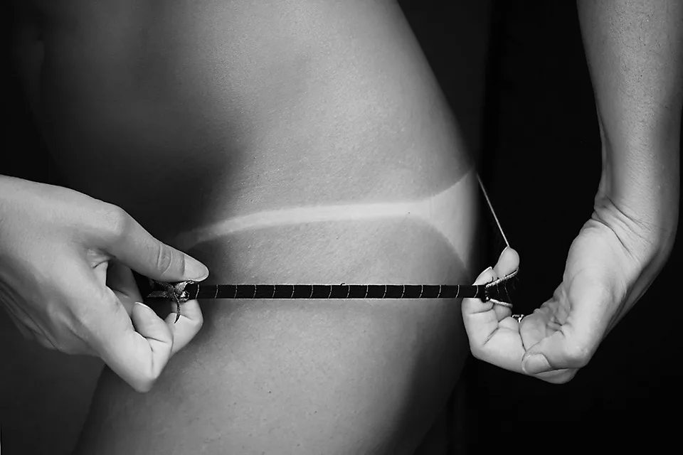 Sonnenbrand Hausmittel: Natürliche Linderung