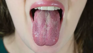 Landkartenzunge