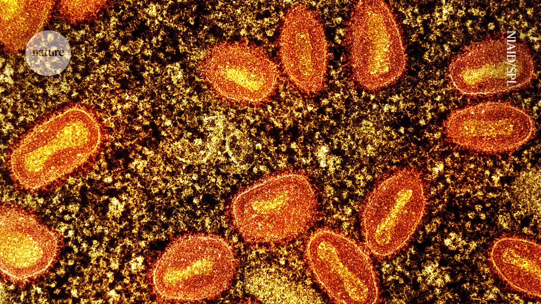 Mpox breitet sich schnell aus: Diese Fragen treiben die Forscher voran